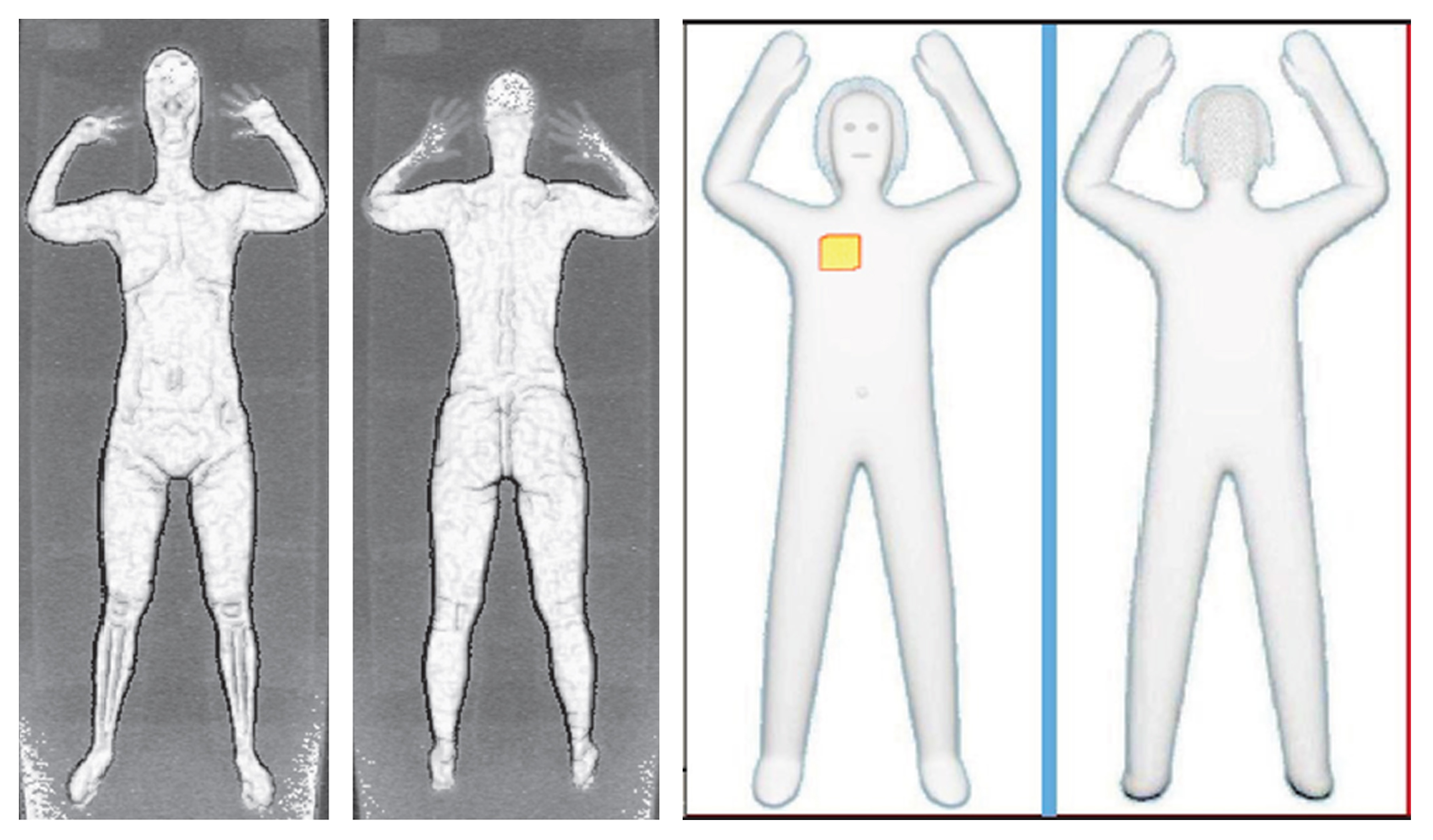 These two sets of images provided by the Transportation Security Administration are samples that show details of what TSA officers see on computer monitors when passengers pass through airport body scanners. At left are two images using backscatter advanced image X-ray technology from the huge scanners that were introduced in 2010 at O'Hare International Airport in Chicago and other airports. At right are images from new scanners using new millimeter wave technology that produces a cartoon-like outline rather than naked images of passengers produced by using X-rays.