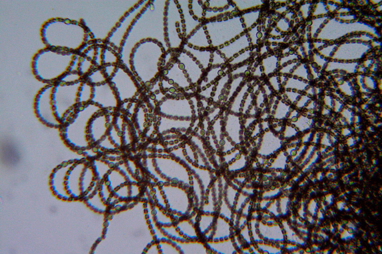 Anderson Lake closed due to nerve toxin