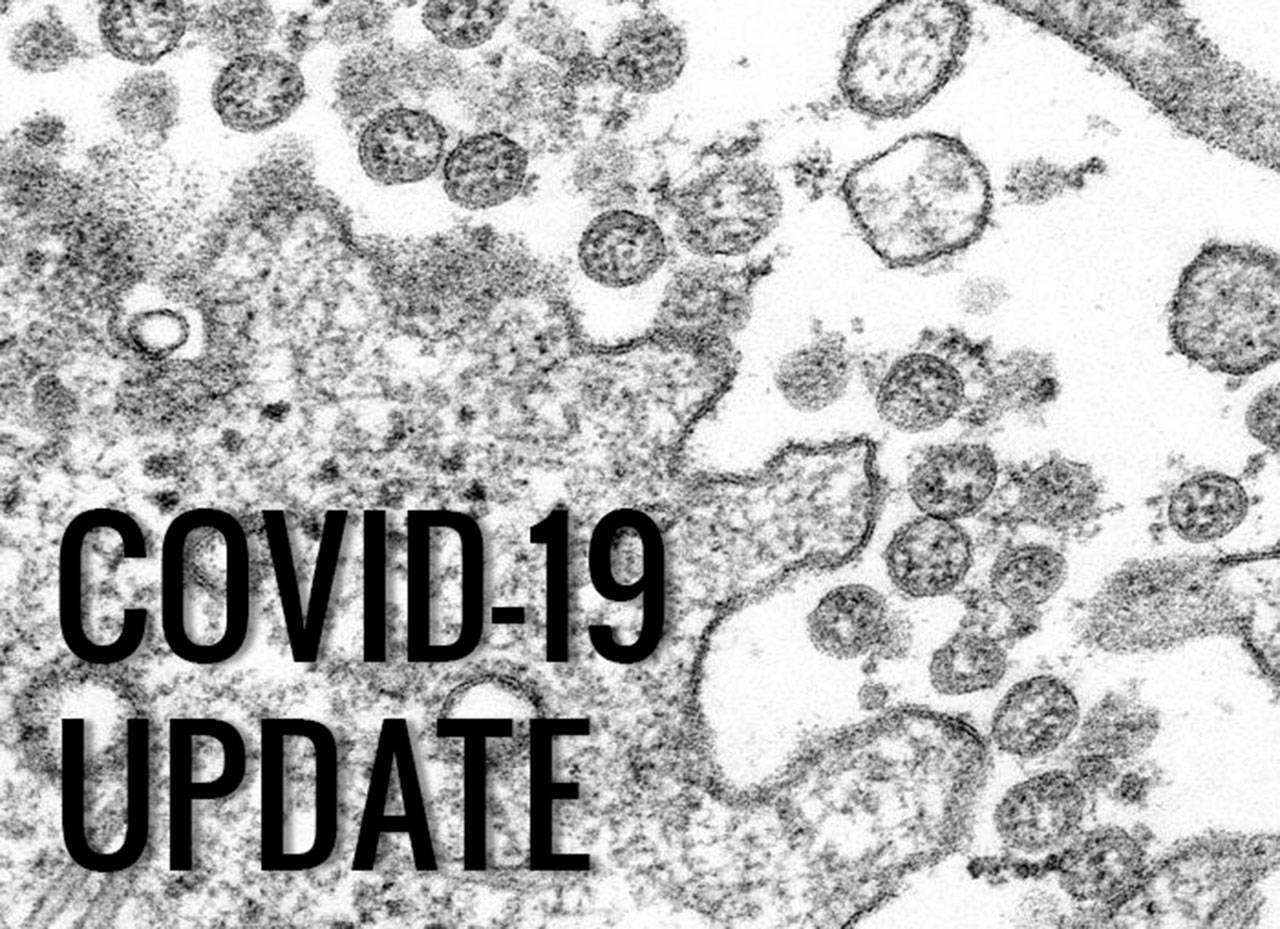Transmission electron microscopic image of an isolate from the first U.S. case of COVID-19, formerly known as 2019-nCoV. The spherical extracellular viral particles contain cross-sections through the viral genome, seen as black dots. (Image provided by the Centers for Disease Control)