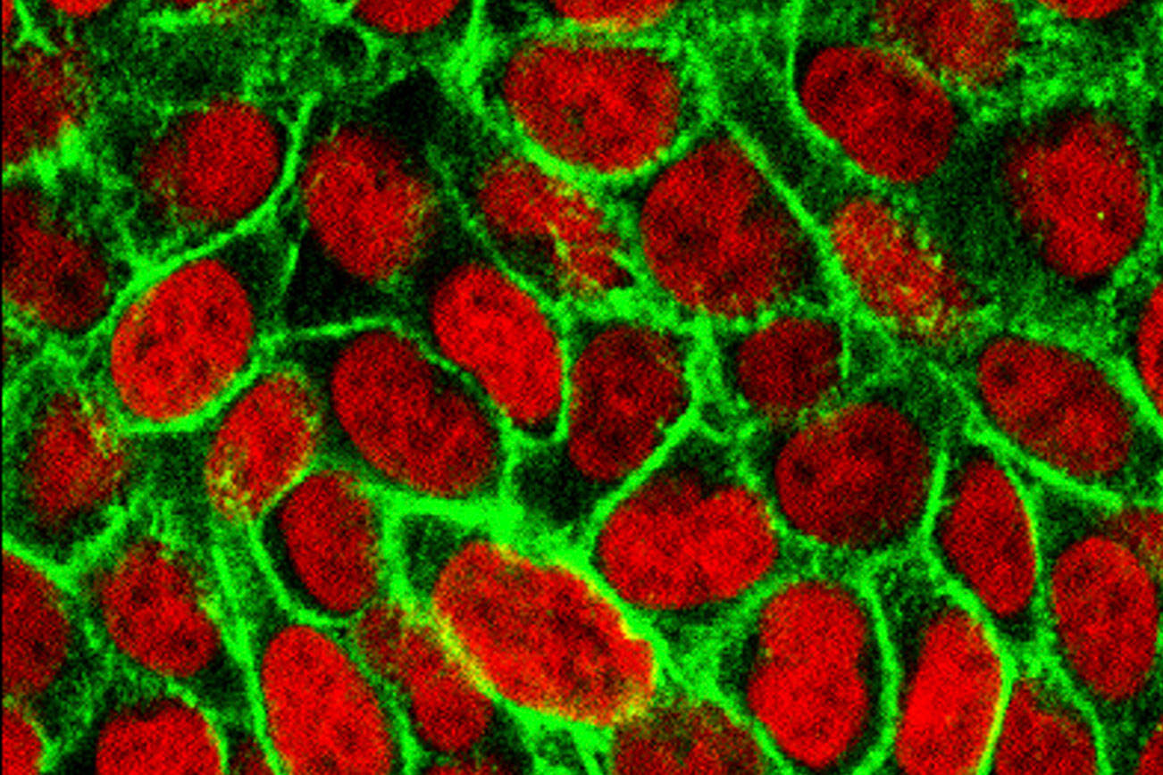 New drugs make headway against lung, prostate, colon cancers