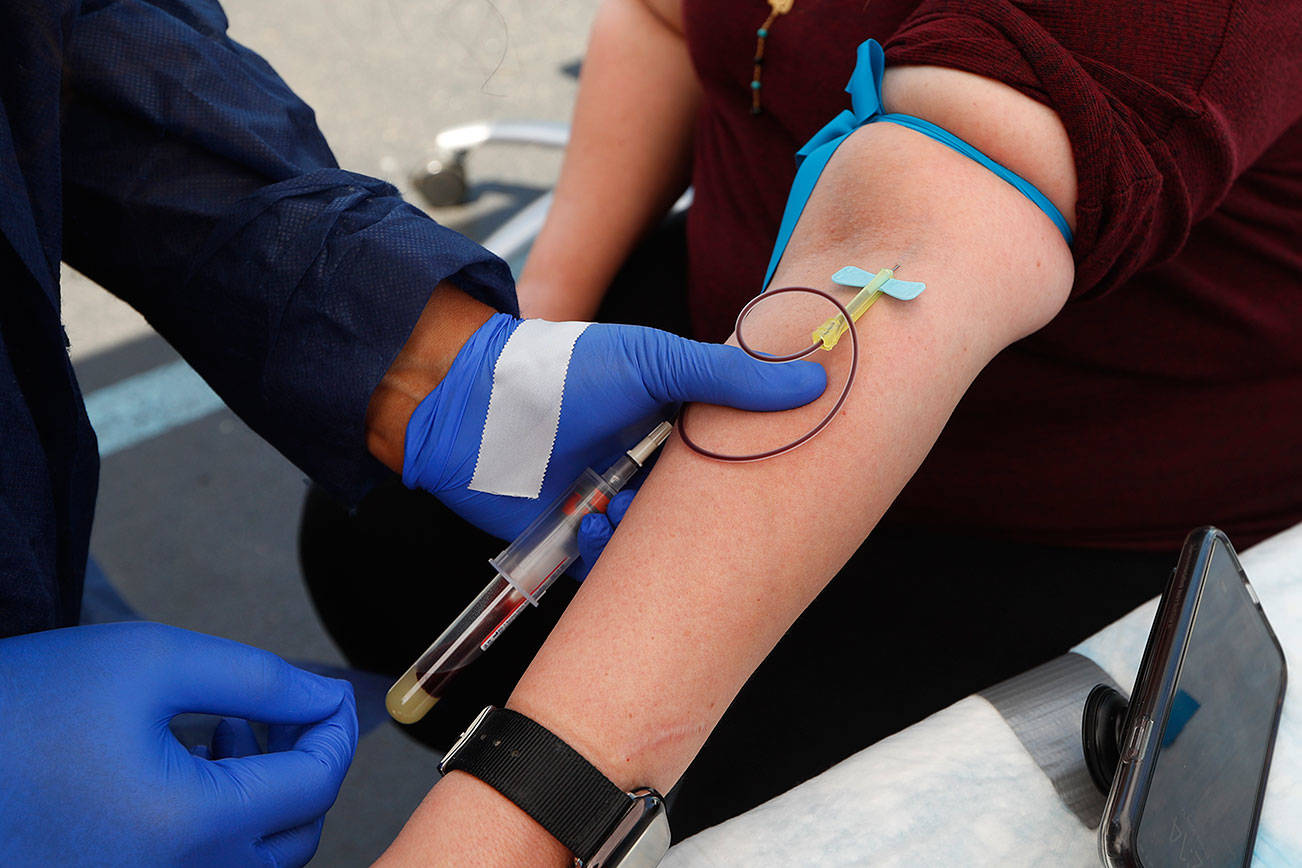 Virus antibodies fade fast, but not necessarily protection