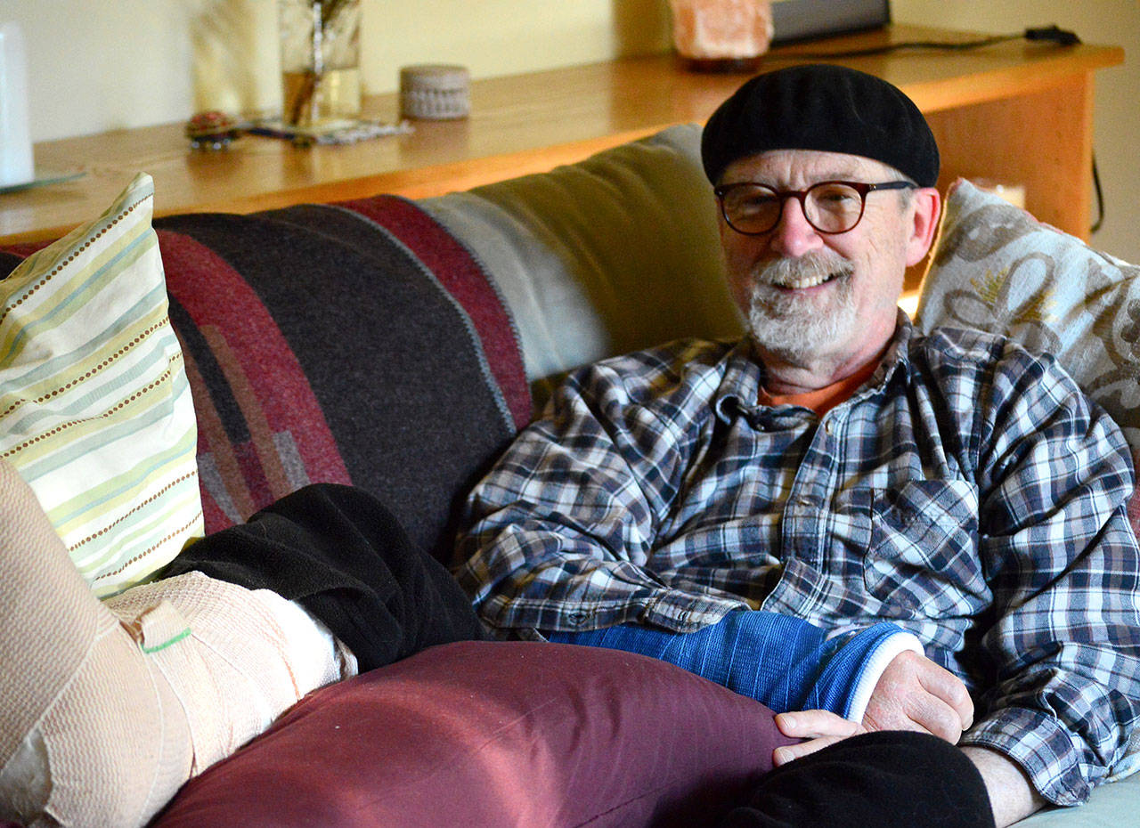 Cyclist Dave Thielk, struck by a tree on Olympic Hot Springs Road last month, is on the mend at home in Port Townsend. (Diane Urbani de la Paz/Peninsula Daily News)