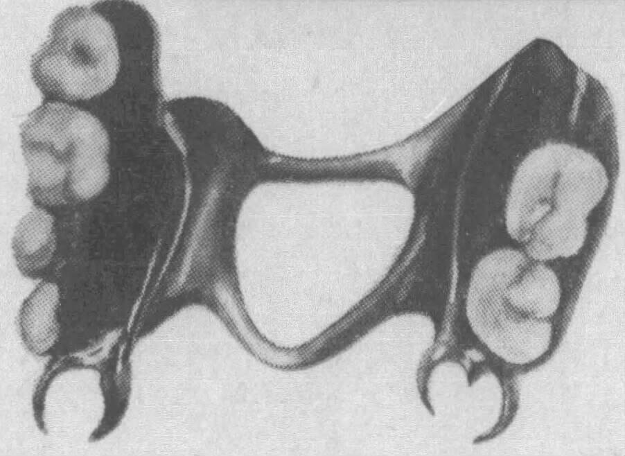 Dental piece found in body discovered at Lake Crescent.